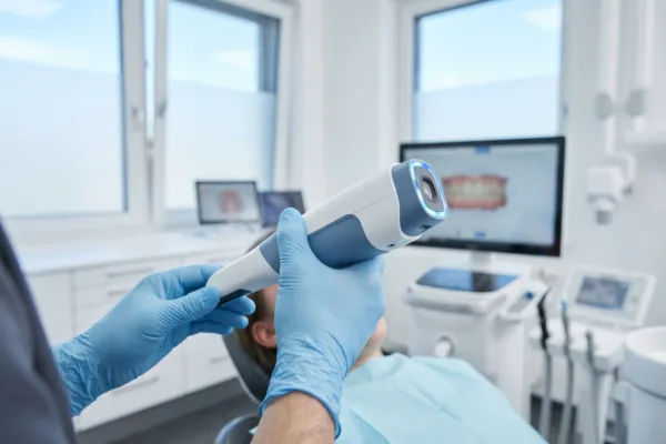 Scanners intra-oraux